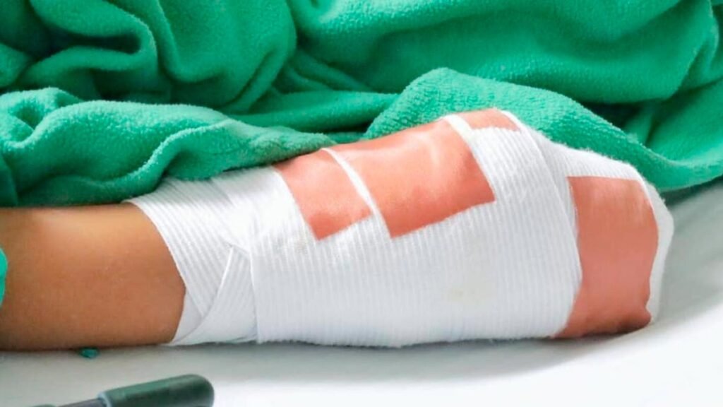 Lesionados con pólvora