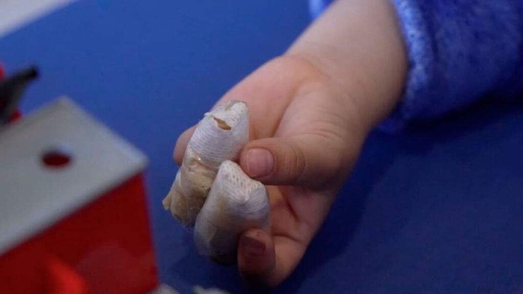 Lesionado por pólvora