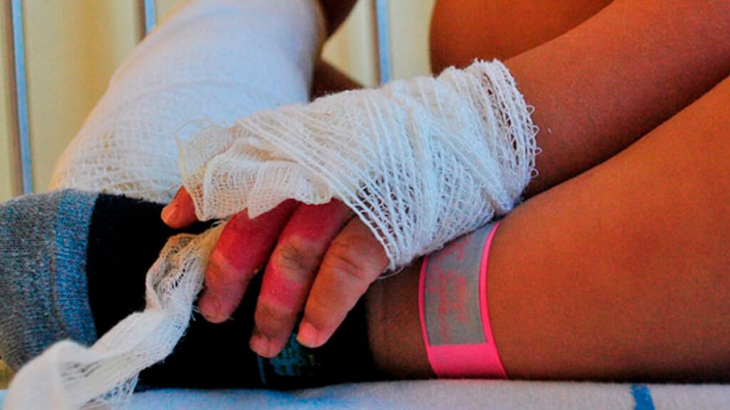 Afectado por pólvora