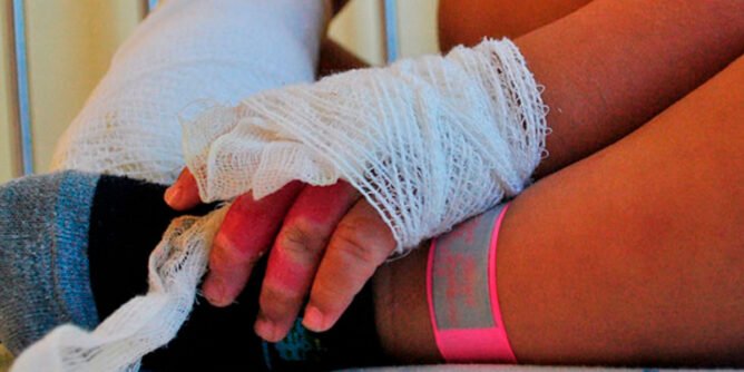 Afectado por pólvora