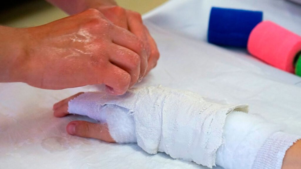 Lesionada por pólvora