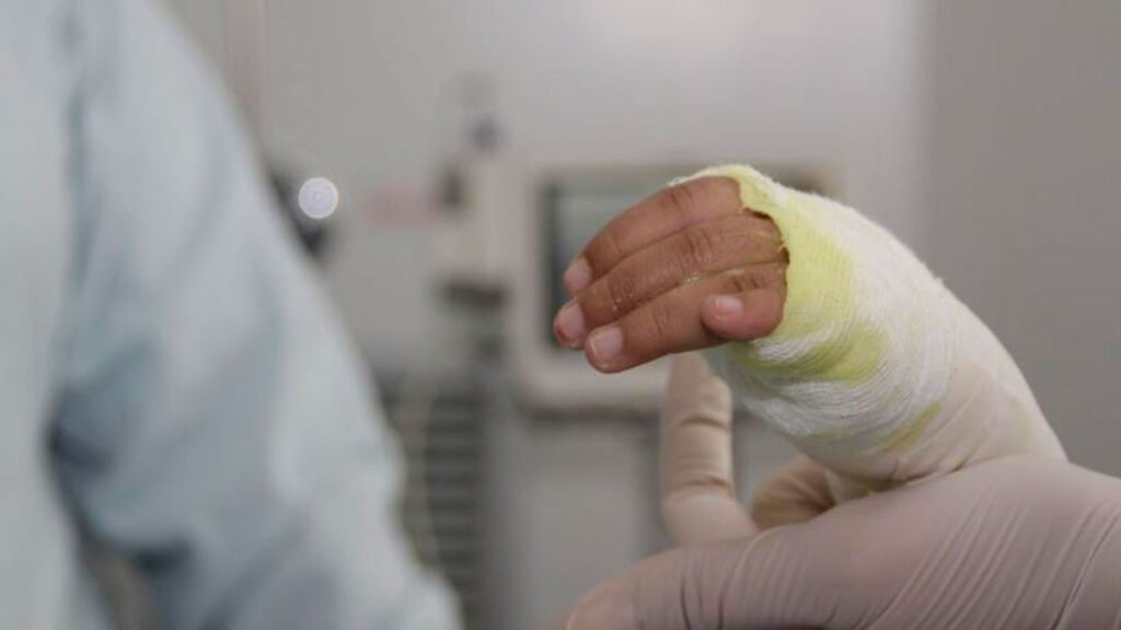 Lesionado por pólvora