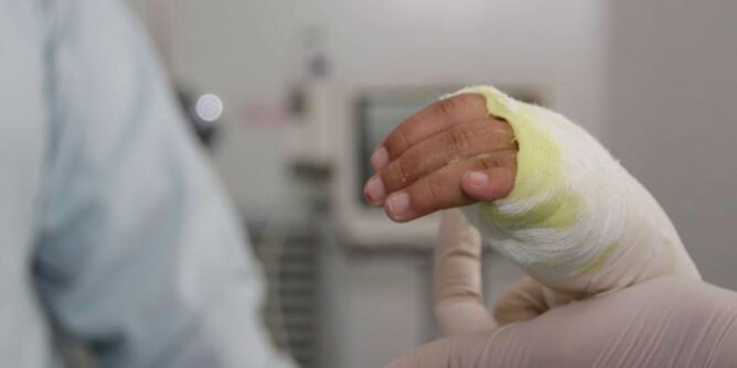 Lesionado por pólvora