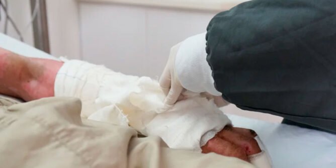 lesionado por pólvora