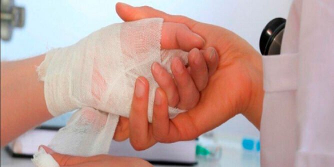 Lesionado por pólvora