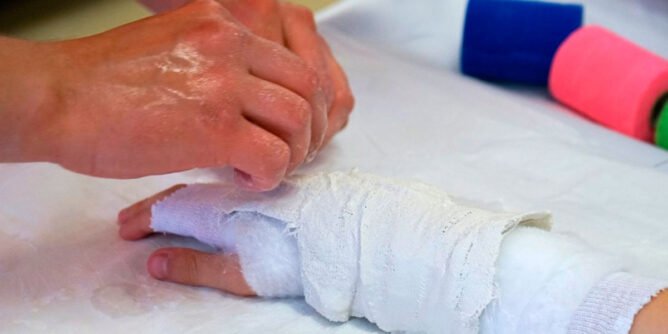 Lesionada por pólvora