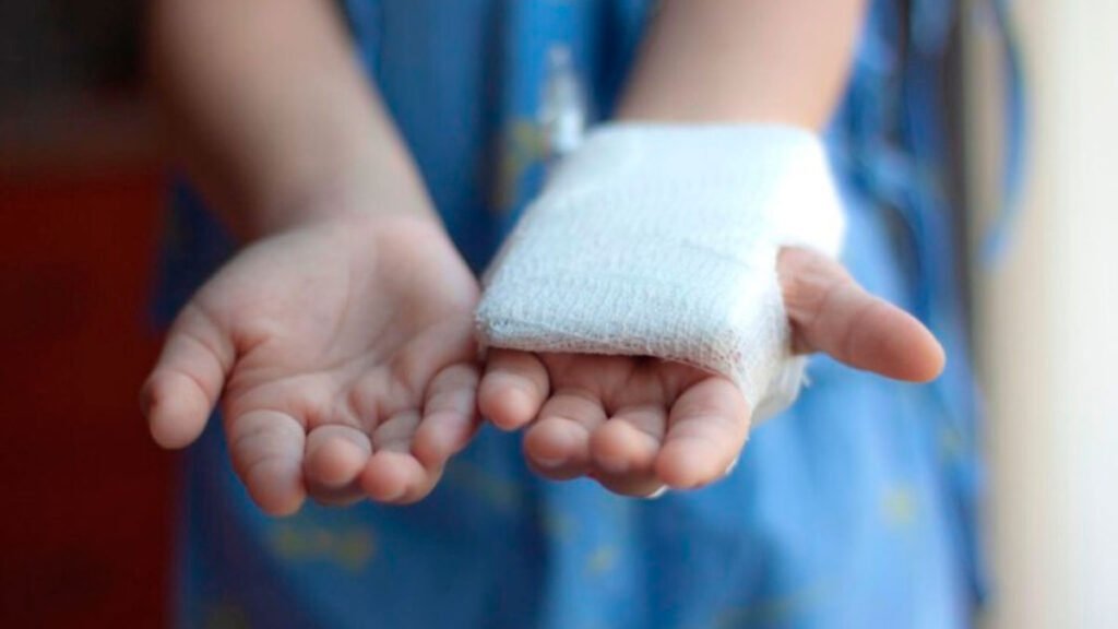 Quemado por pólvora