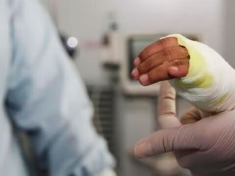 Quemado por pólvora