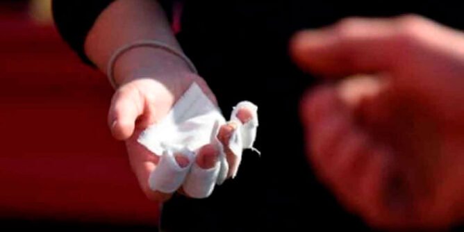 Quemado por pólvora