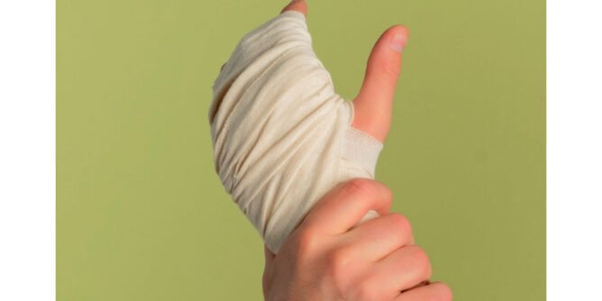 Quemado por pólvora