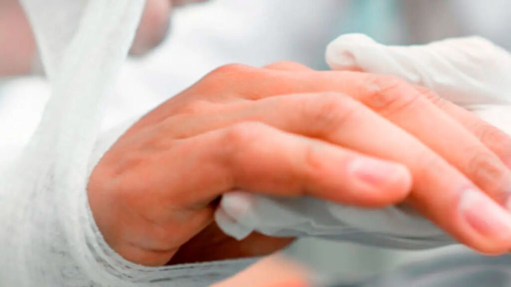 Lesionado por pólvora