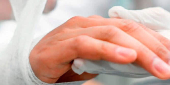 Lesionado por pólvora