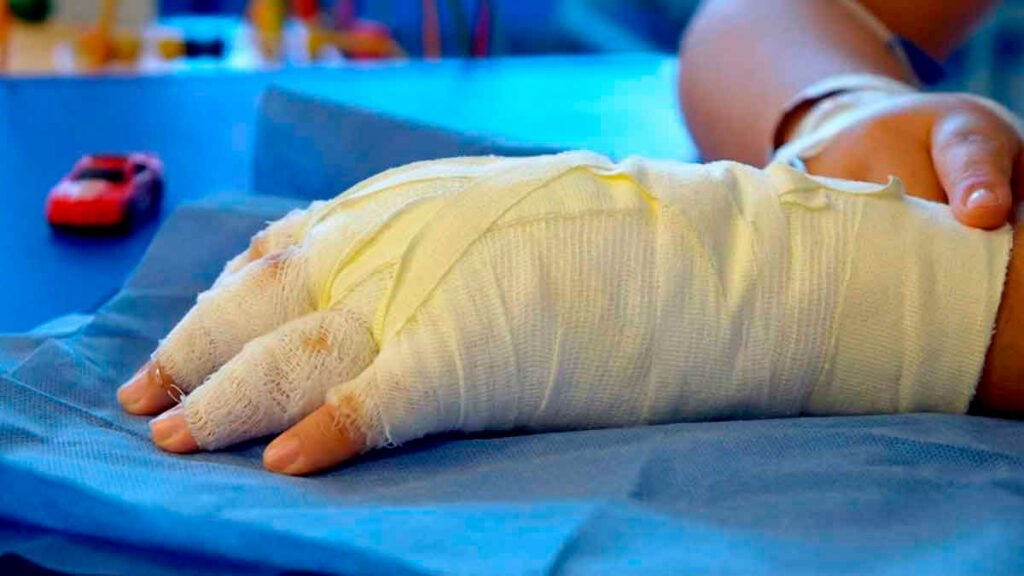 Quemado por pólvora