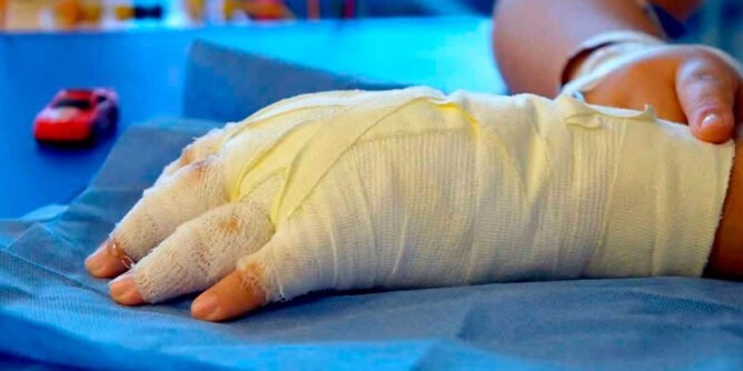 Quemado por pólvora